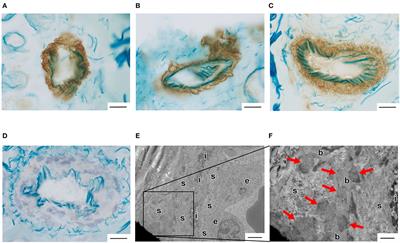 Detection of Vascular Notch3 Deposits in Unfixed Frozen Skin Biopsy Sample in CADASIL